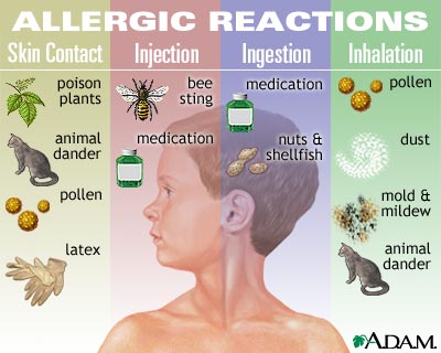 What is considered a mild allergic reaction